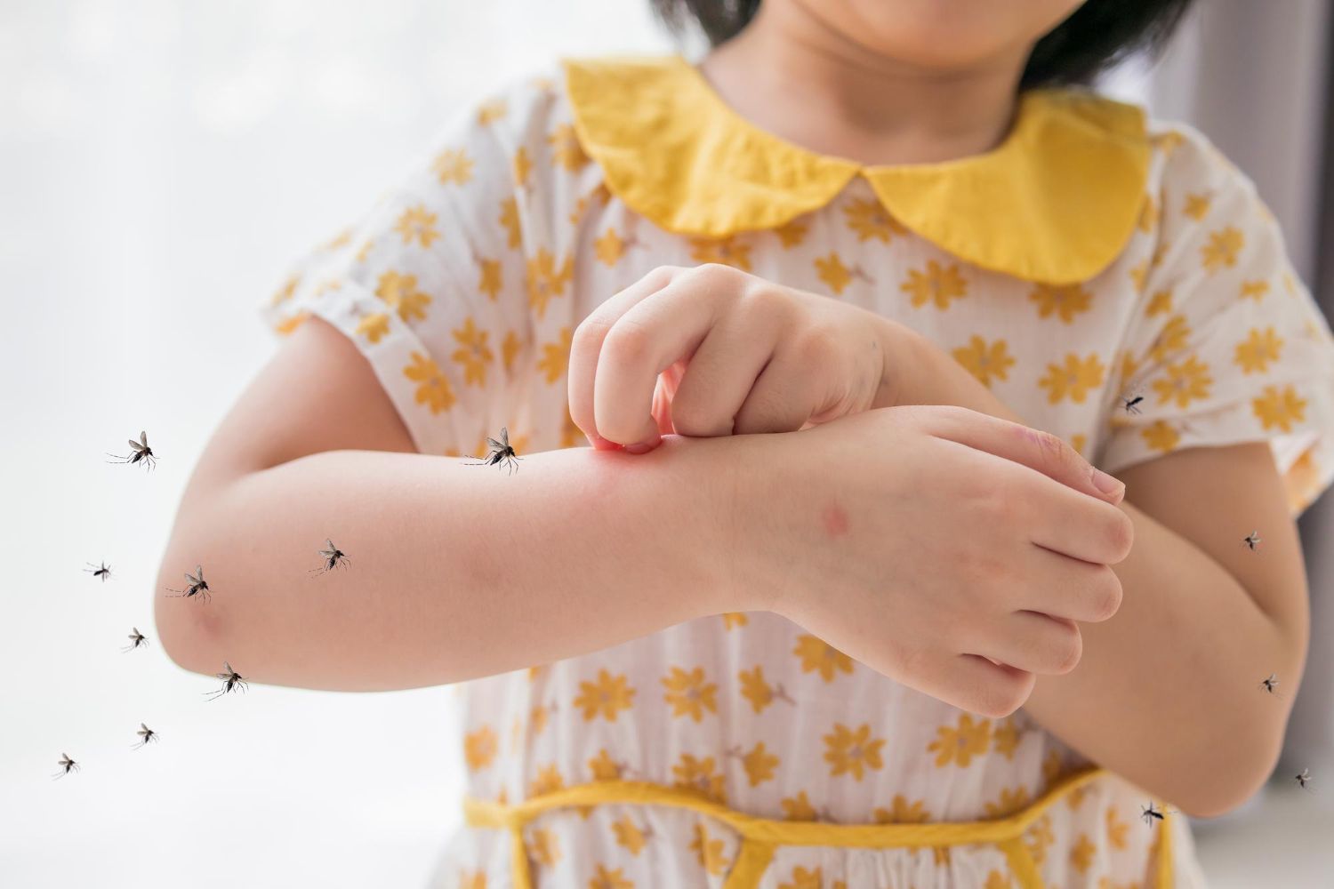 A little girl is scratching her arm with mosquitoes.