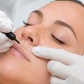 Gloved hands use a cosmetic needle on a woman’s upper lip during a beauty treatment