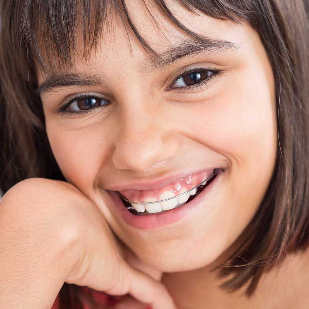 Beautiful smile with orthodontic appliance