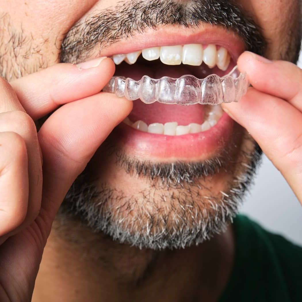 young African American man holding clear aligners