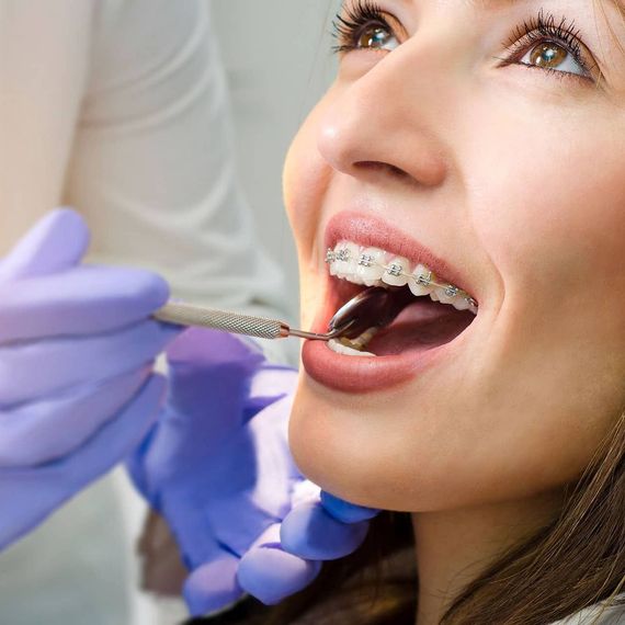A young girl wearing glasses is smiling while holding a model of teeth and braces
