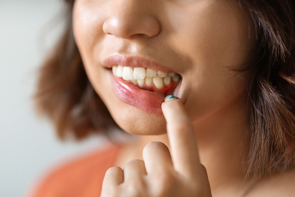 Gum Disease, Root Canals Near Oak Point TX 75068 Patient taking a dental exam