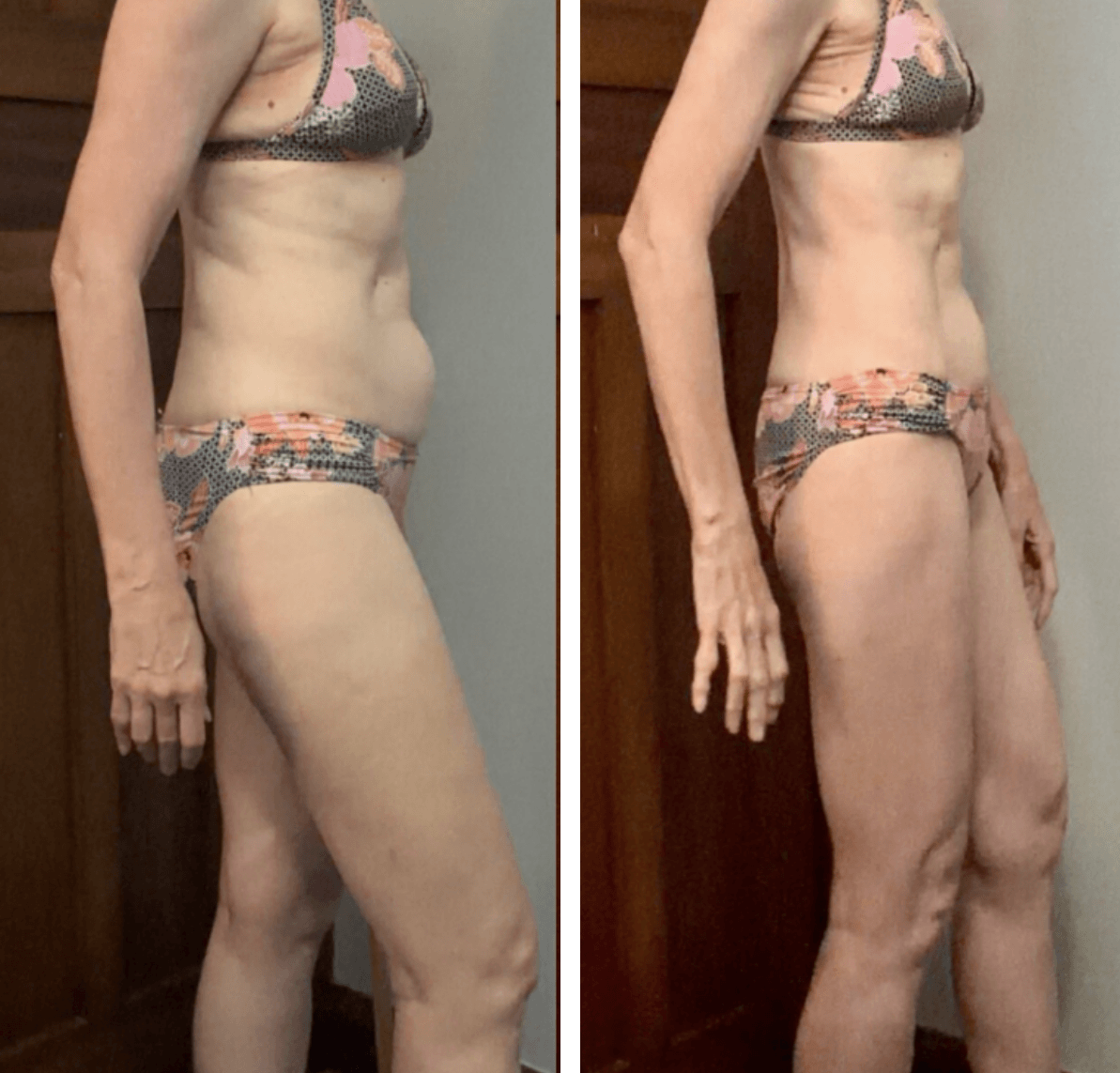 Side-profile before and after photos of a woman in a floral bikini, cropped below the shoulders. Both photos show her standing beside a wooden door, with her arms relaxed at her sides.