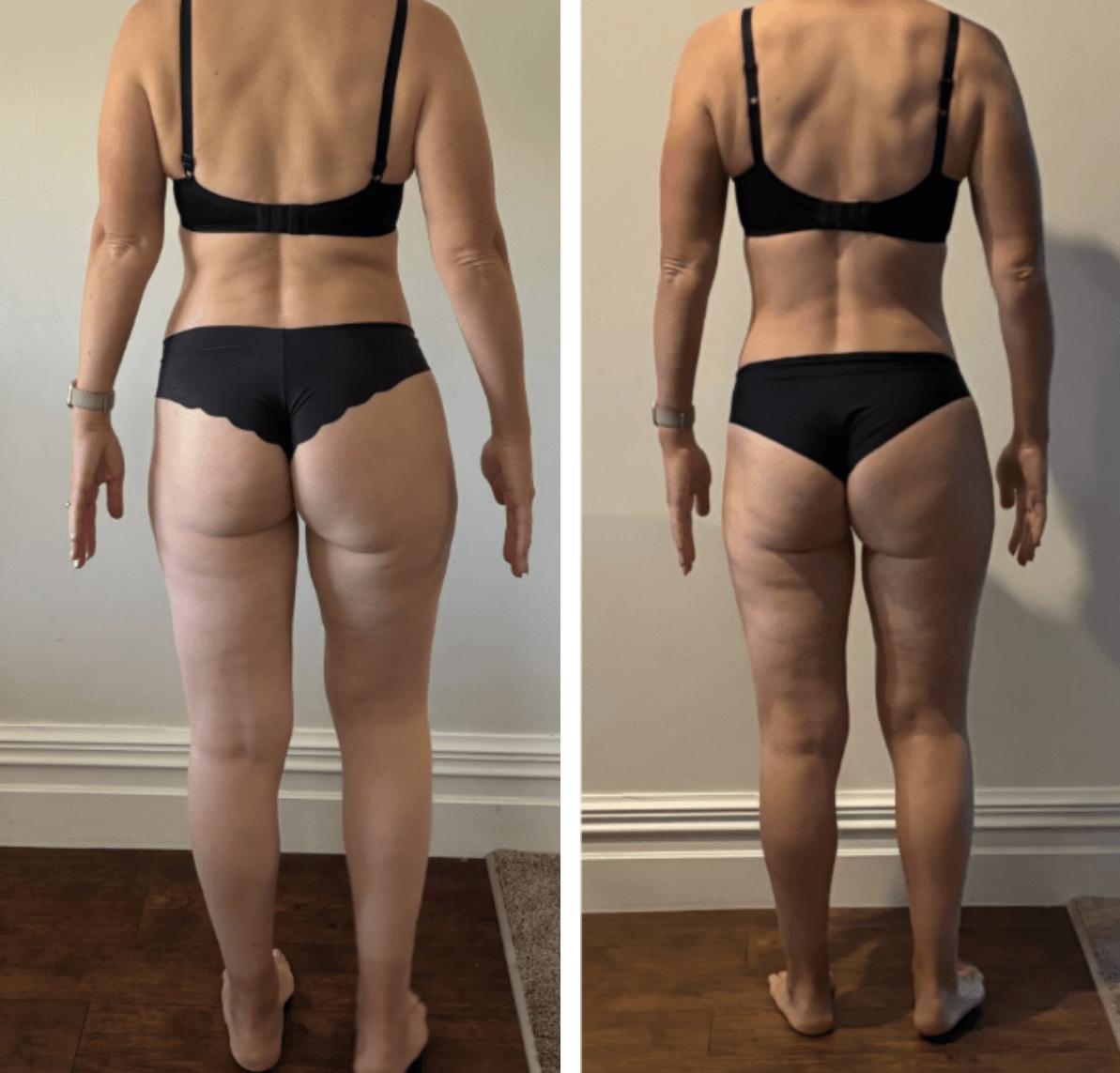 The Embodied Collective Member Results. Back-view before and after photos of a woman in black underwear, standing with her arms relaxed at her sides on a wood floor in front of a white wall.
