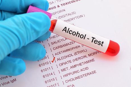 Onsite Drug And Alcohol Testing — Safe Industries Group Lake Macquarie NSW Onsite Drug And Alcohol Testing — Safe Industries Group Lake Macquarie NSW