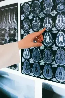 X-ray