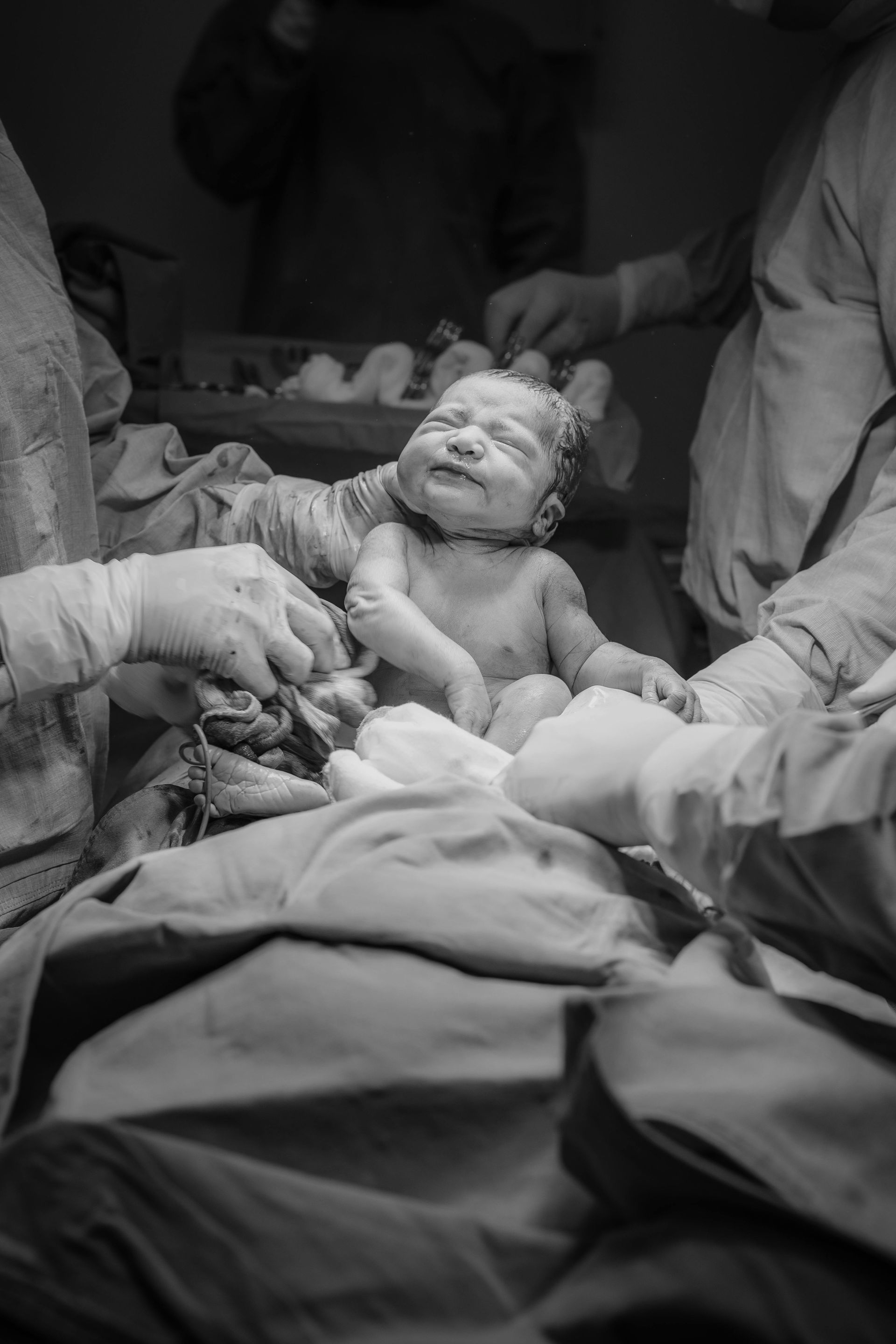 Newborn baby surrounded by medical staff after delivery in an operating room.