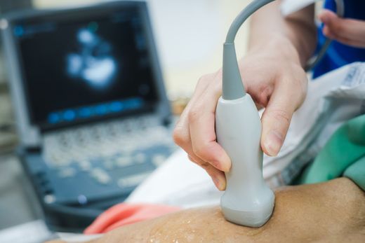 Ultrasound probe held on a patient’s abdomen beside a medical monitor