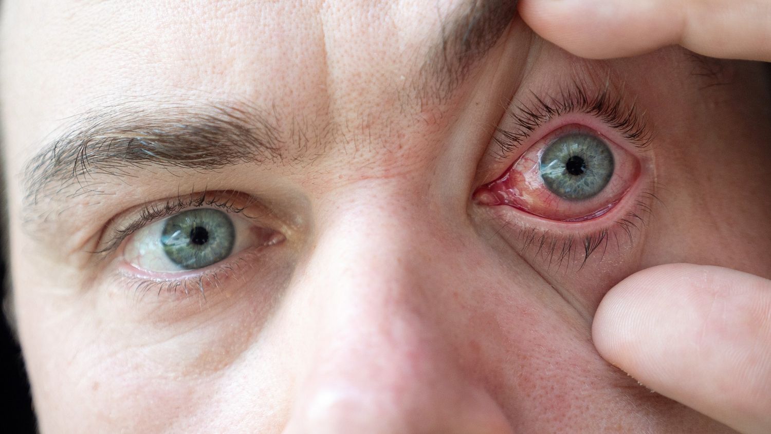 Baisse de vision, œil rouge, douleur, éclairs, corps étranger ou traumatisme ? Découvrez quand consu