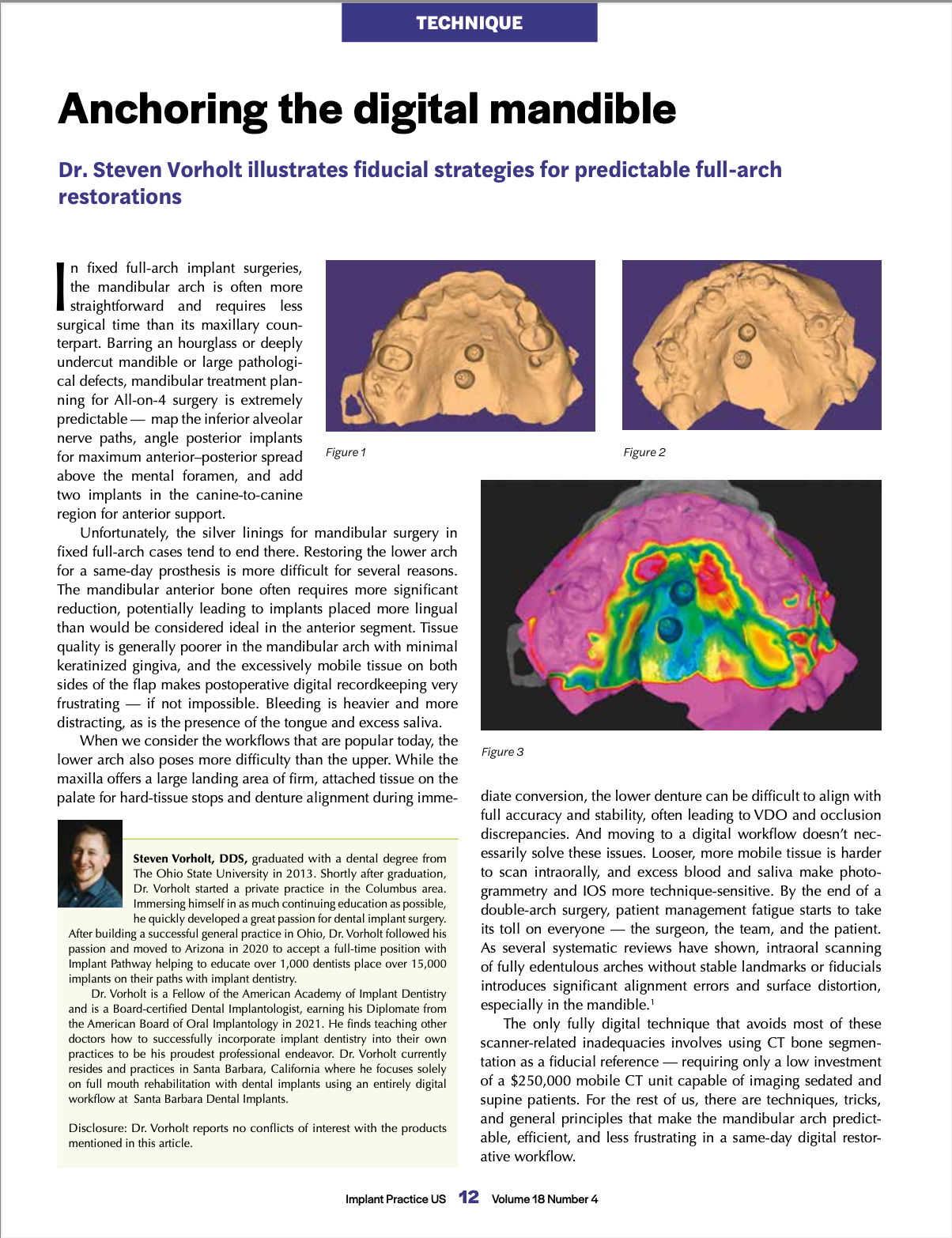 Download PDF First page of the article Anchoring the Digital Mandible by Dr. Steven Vorholt.