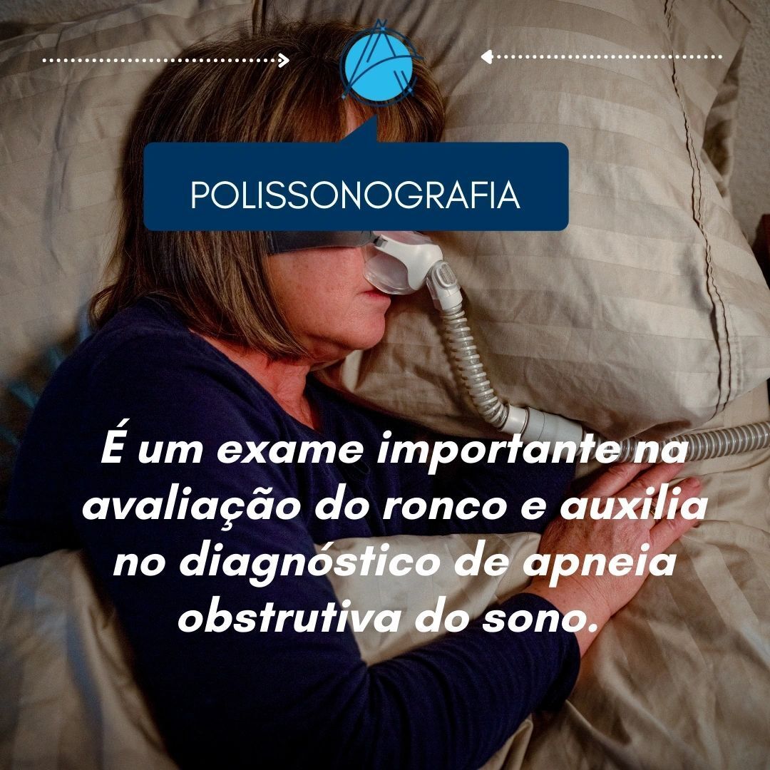polissonografia polissonografia