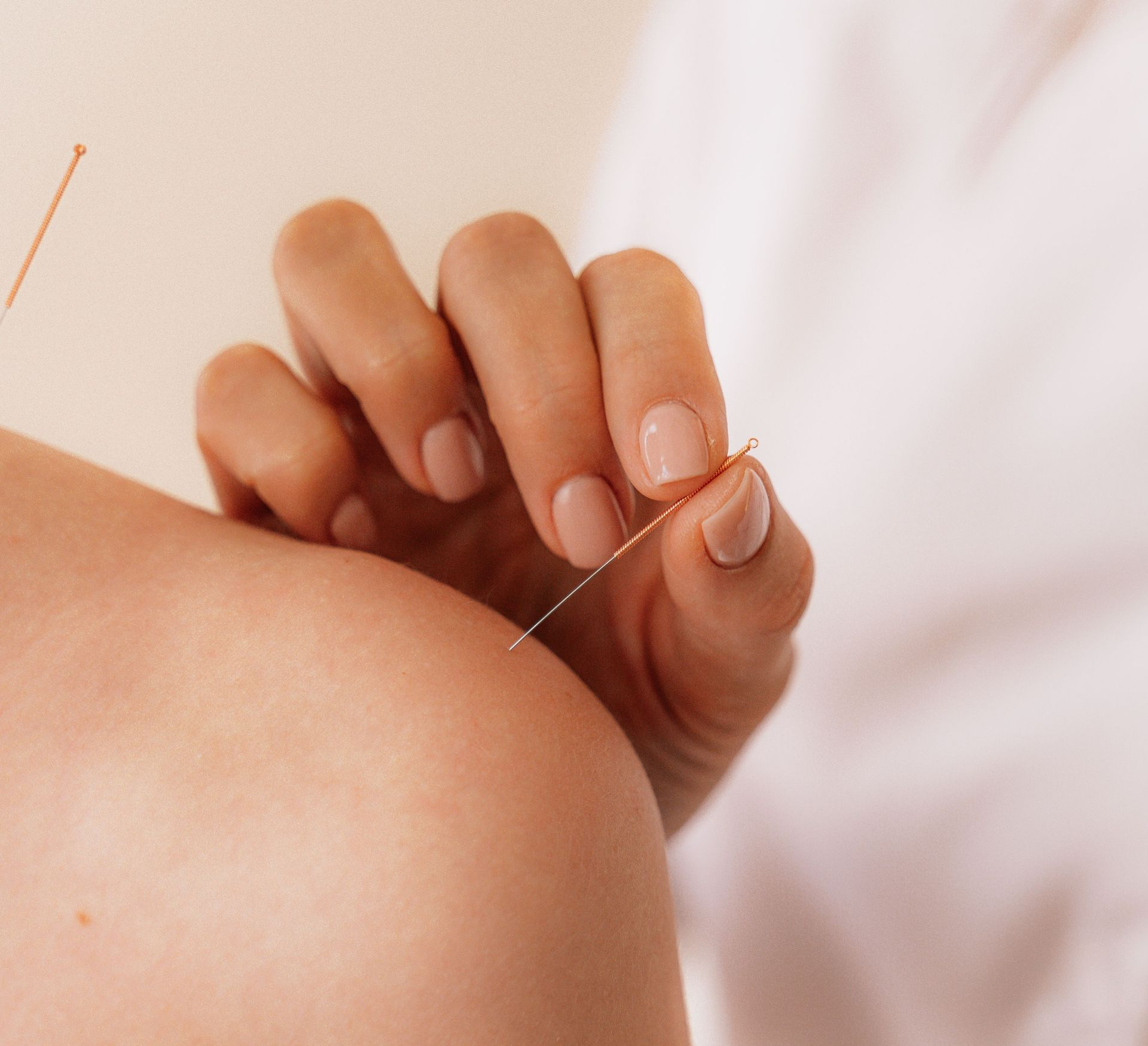 Borrego Acupuncture photo