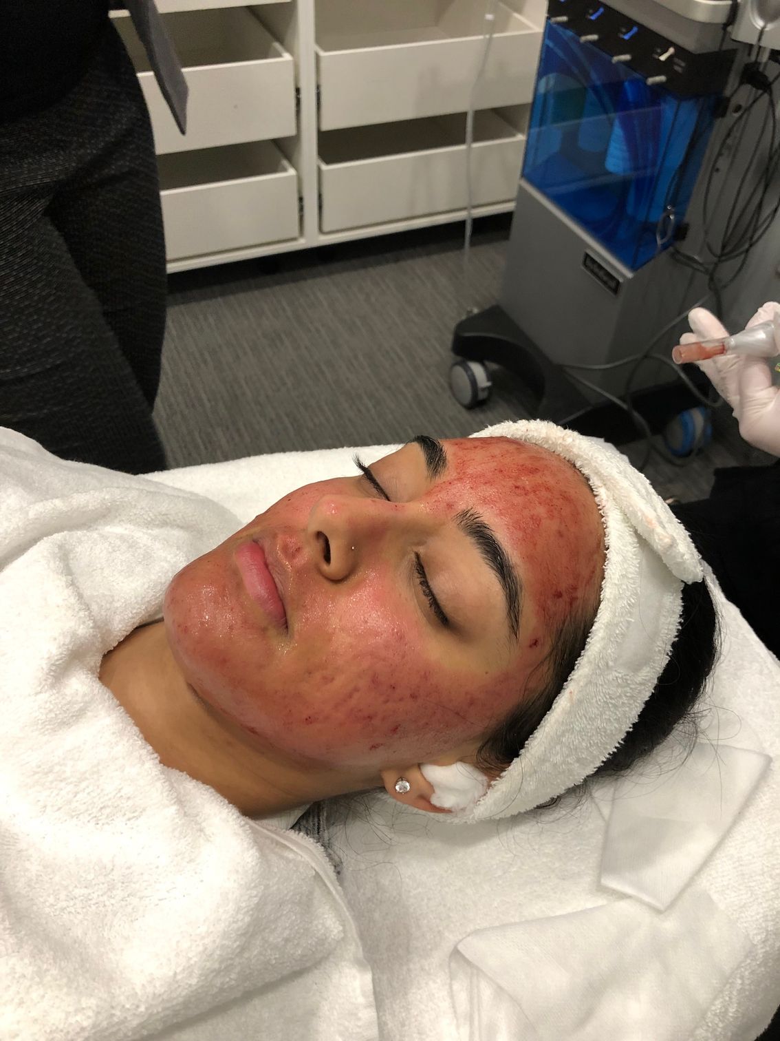 customer getting prp