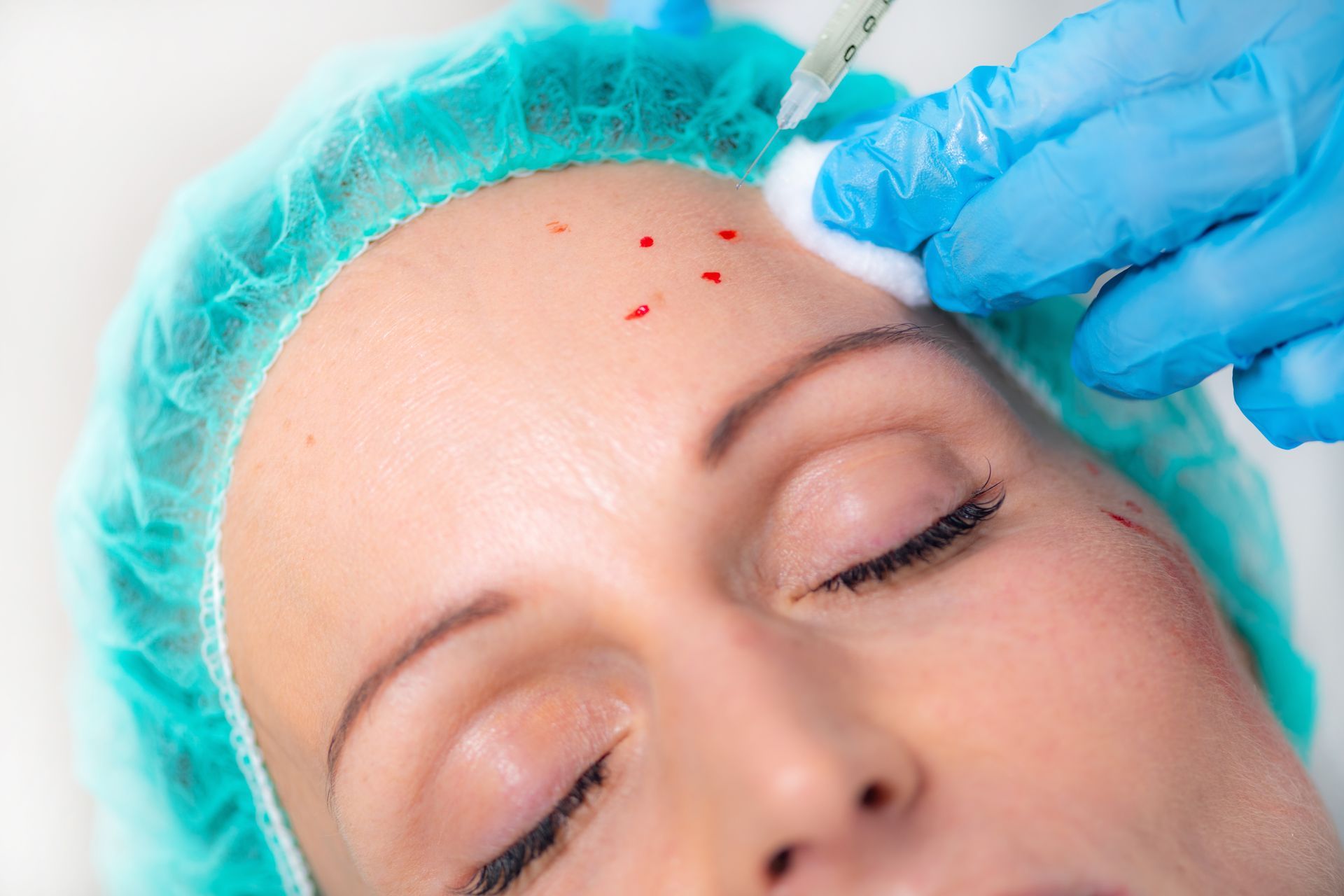prp treatment for skin rejuvenation