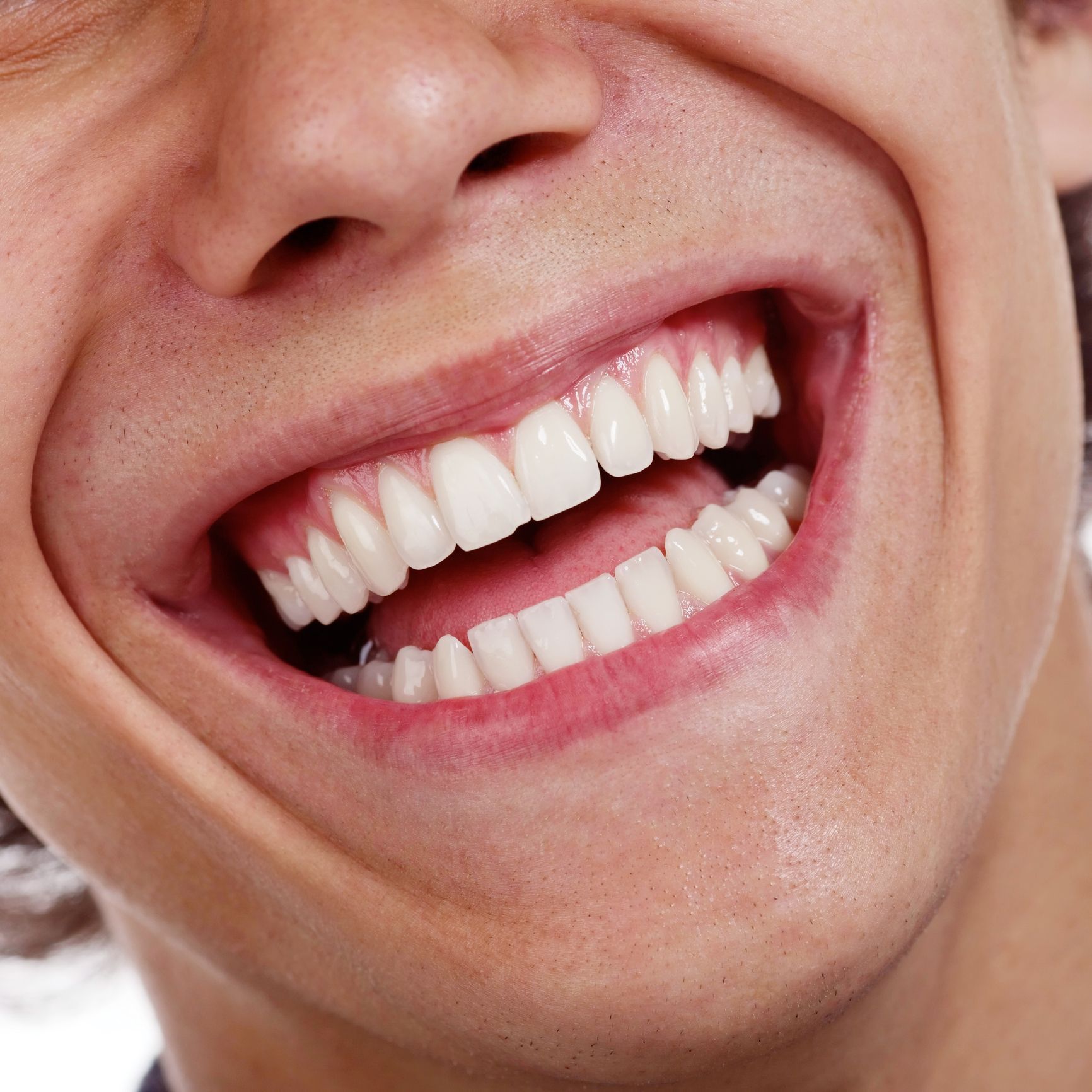 A close up of a man 's mouth with his teeth showing