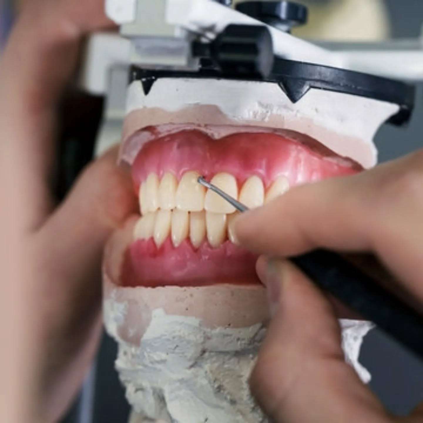 A Person is Holding a Model of a Person's Teeth — Cairns Precision Dental Group In Woree, QLD