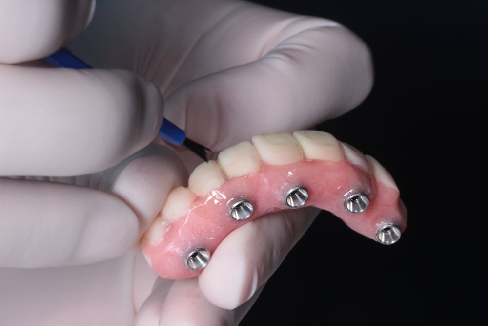 A Person is Holding a Denture With Screws on It — Cairns Precision Dental Group In Woree, QLD