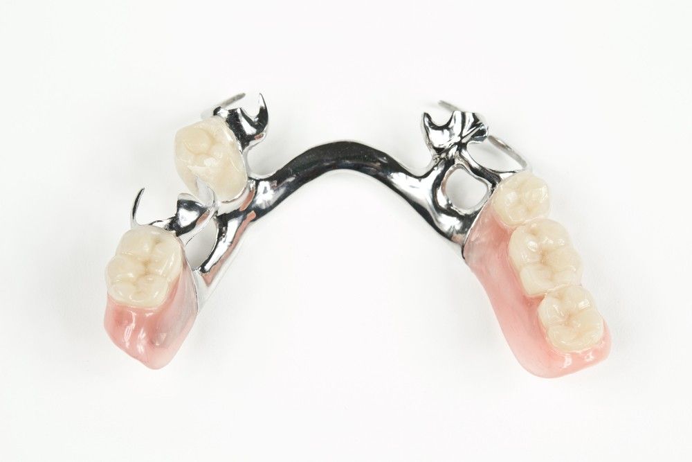 Precision metal denture by Cairns Precision Dental Group, Woree QLD