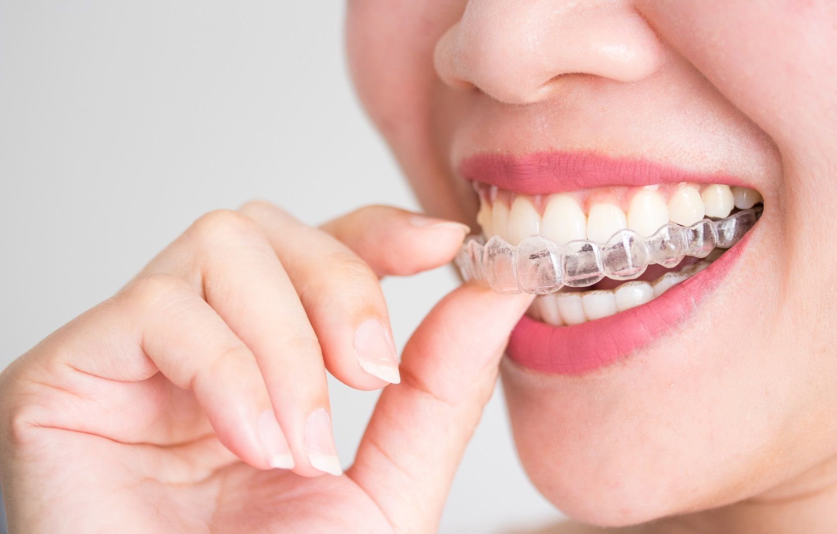 A woman is holding a clear brace in her mouth.