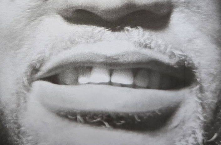 Close-up of a smiling mouth with visible teeth in black and white.