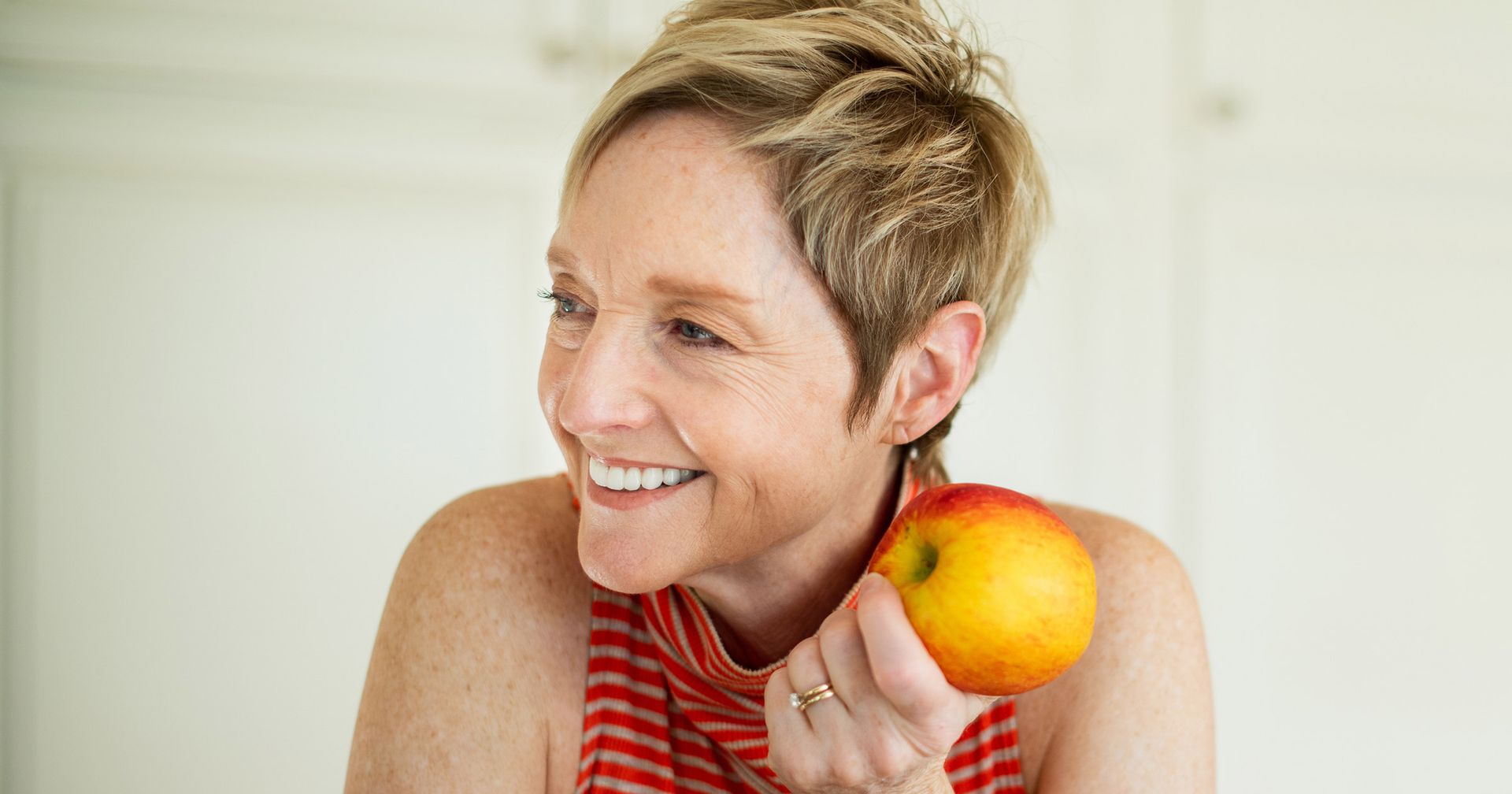 permanent full mouth dental implants, dental implants Fairfax VA