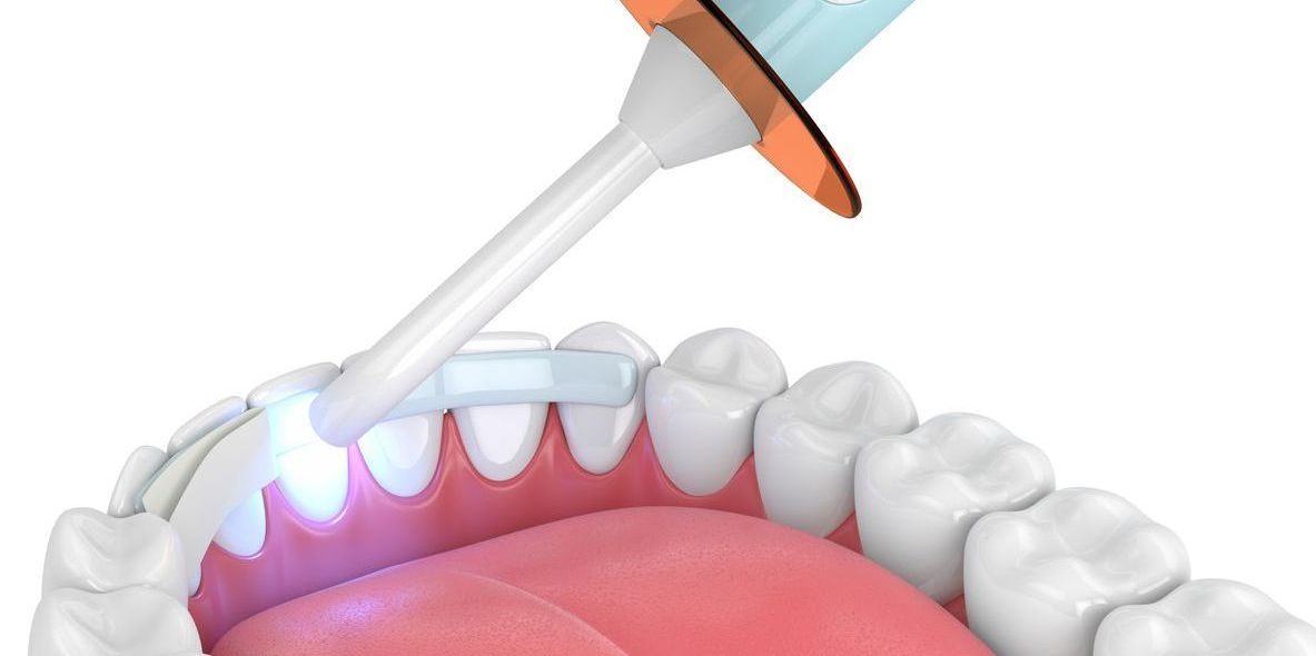 A person is getting their teeth whitened with a light.