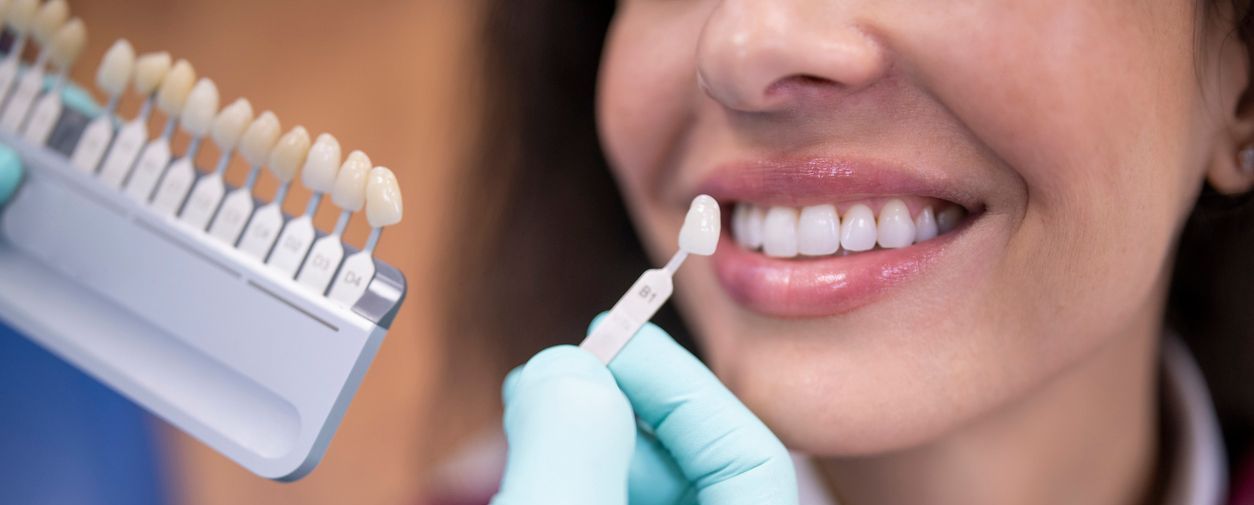 A woman is getting Veneers from a dentist.
