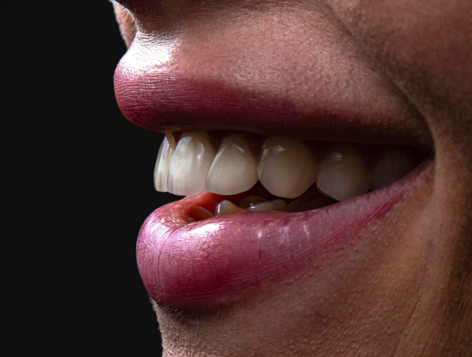 A close up of a woman 's mouth with her teeth showing.