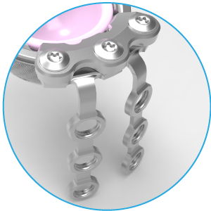 modular cup fixation