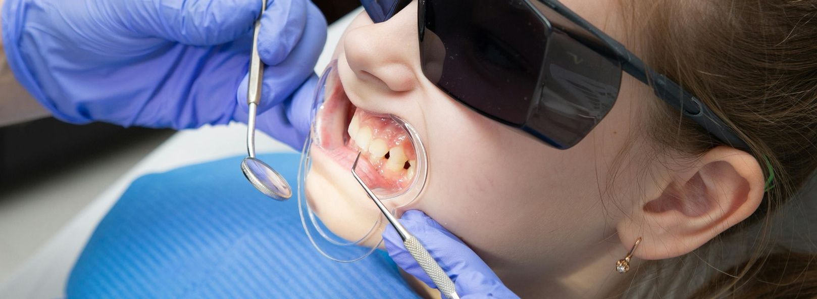 Pediatric Dentistry