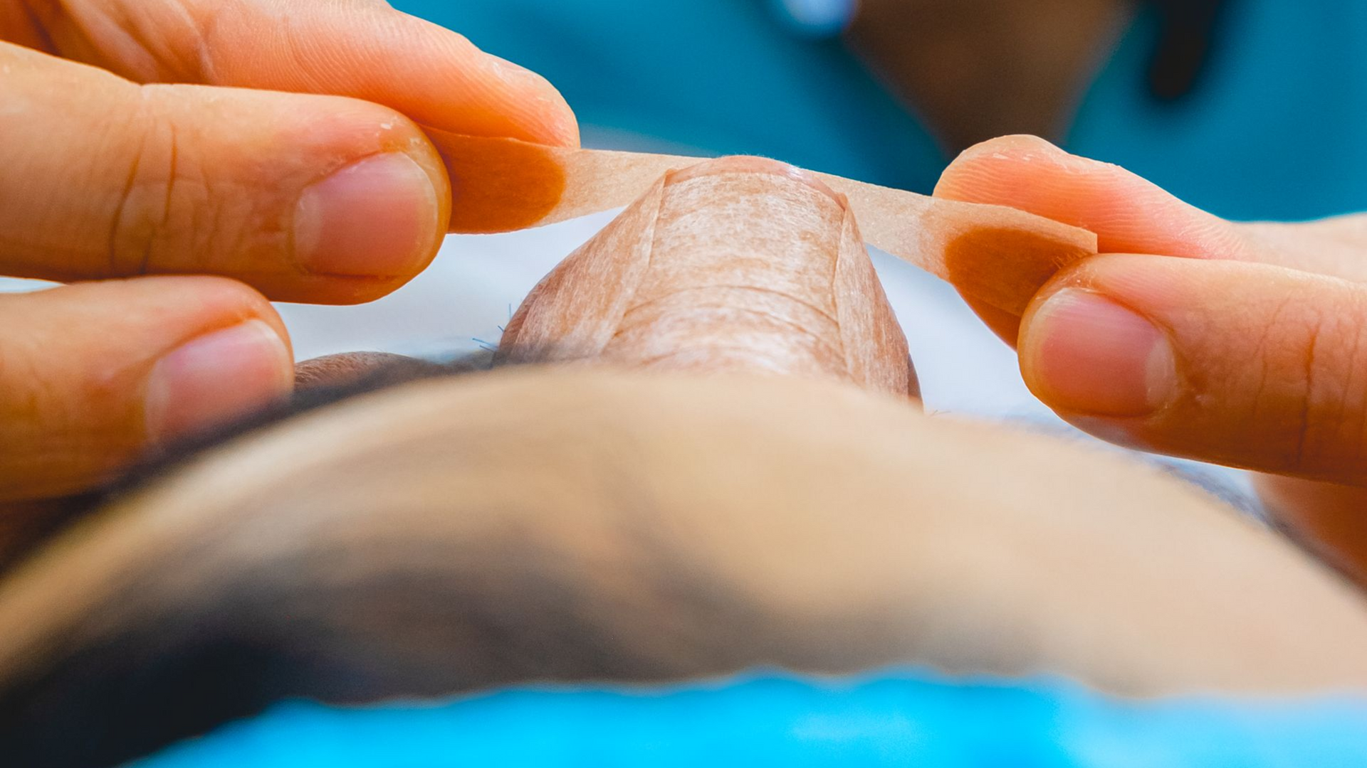 Manos que retiran o aplican delicadamente puntos de sutura en la piel durante un procedimiento médico de primer plano.