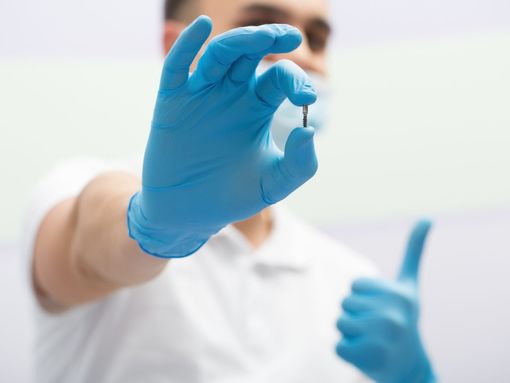Dental Implants Knoxville