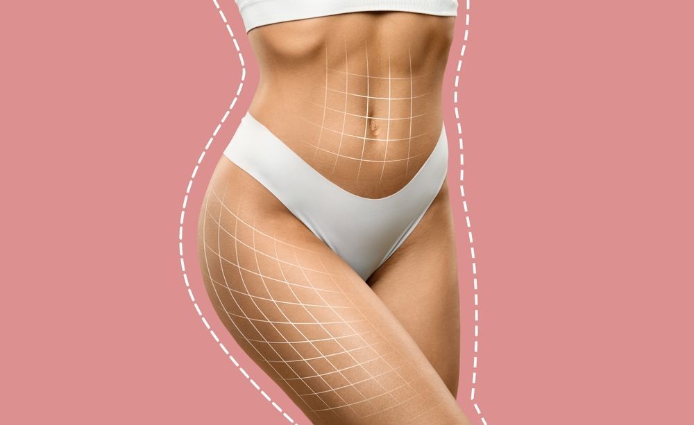 Body with markings, showing surgical area on abdomen and thigh, against a pink backdrop.