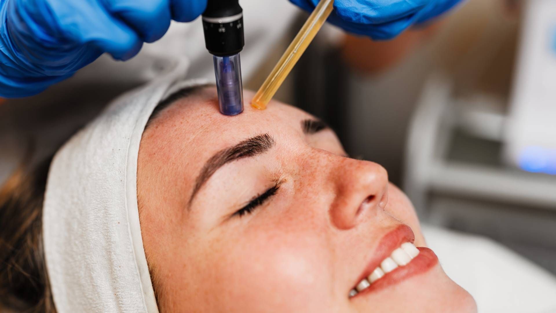 Woman receiving a micro-needling facial treatment. Close up of forehead with tool and gloved hands.