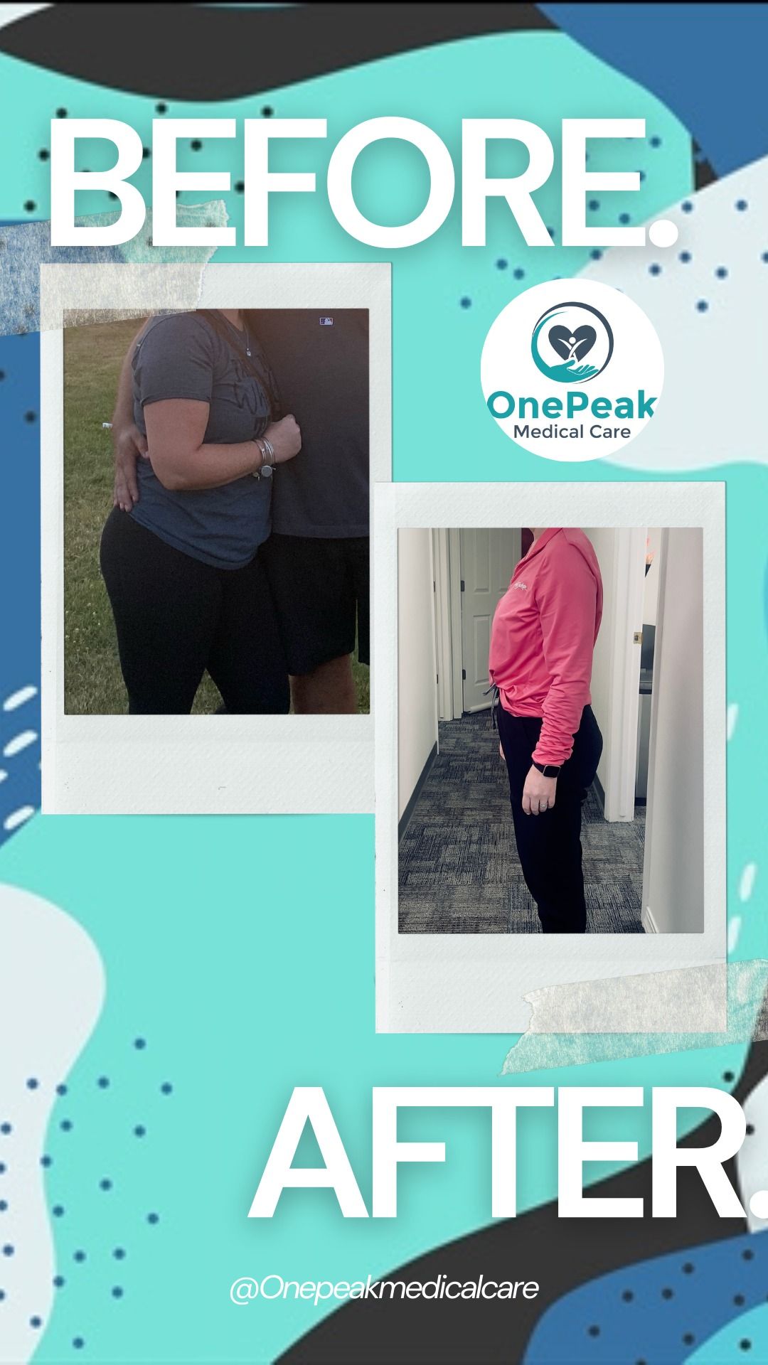 A before and after picture of a woman 's weight loss.