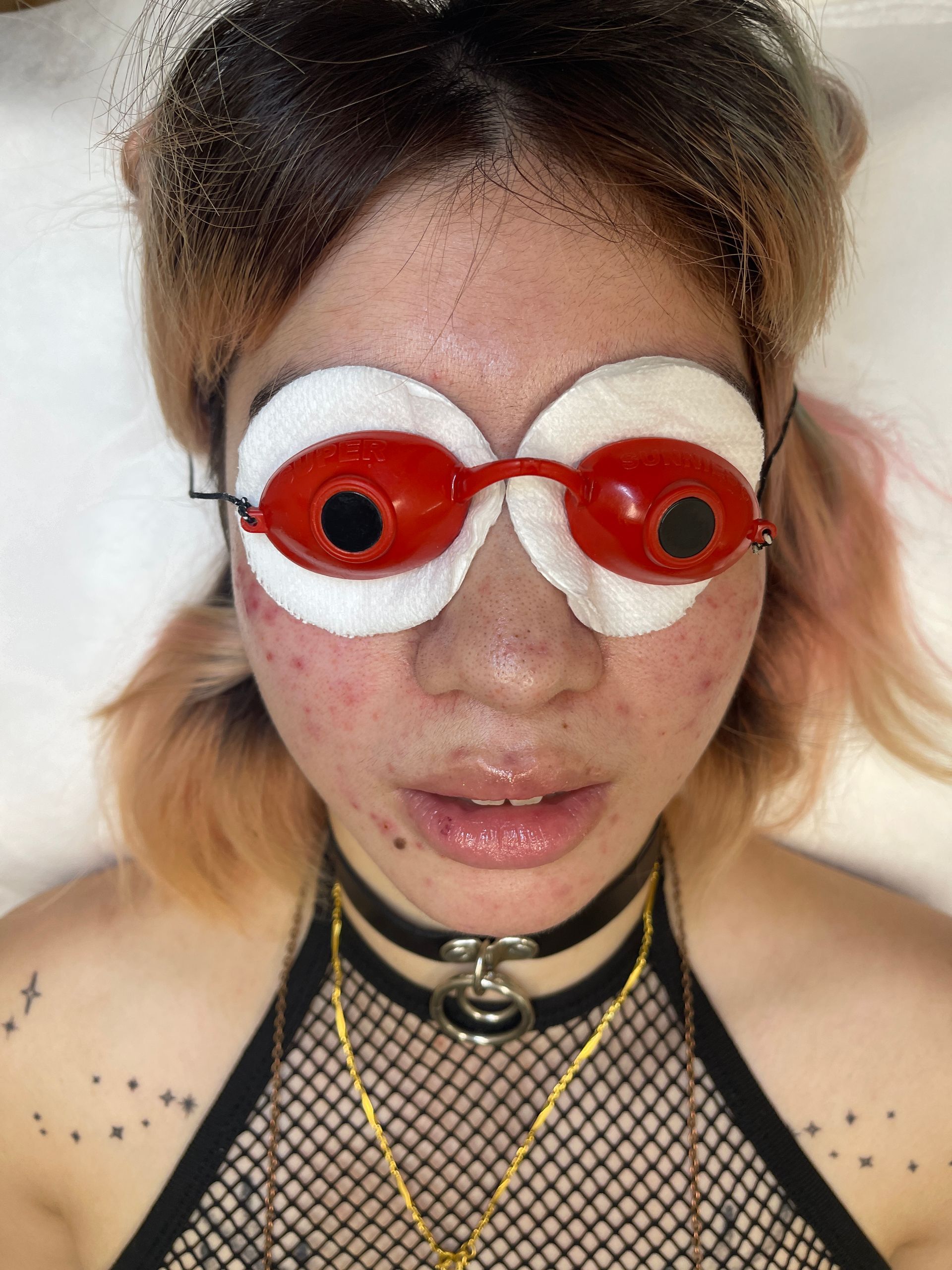 facial treatment
