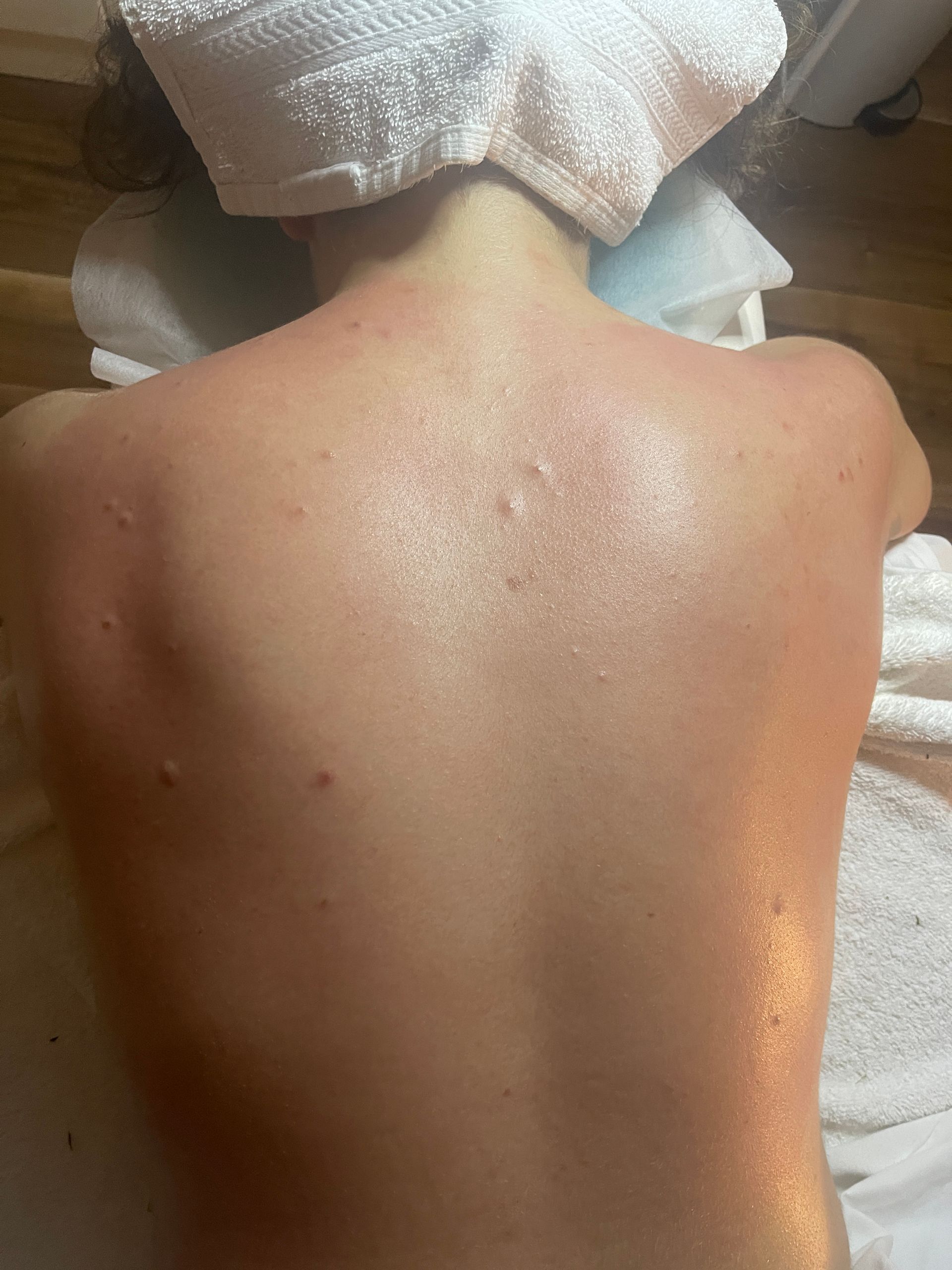 After Back Facial Treatment