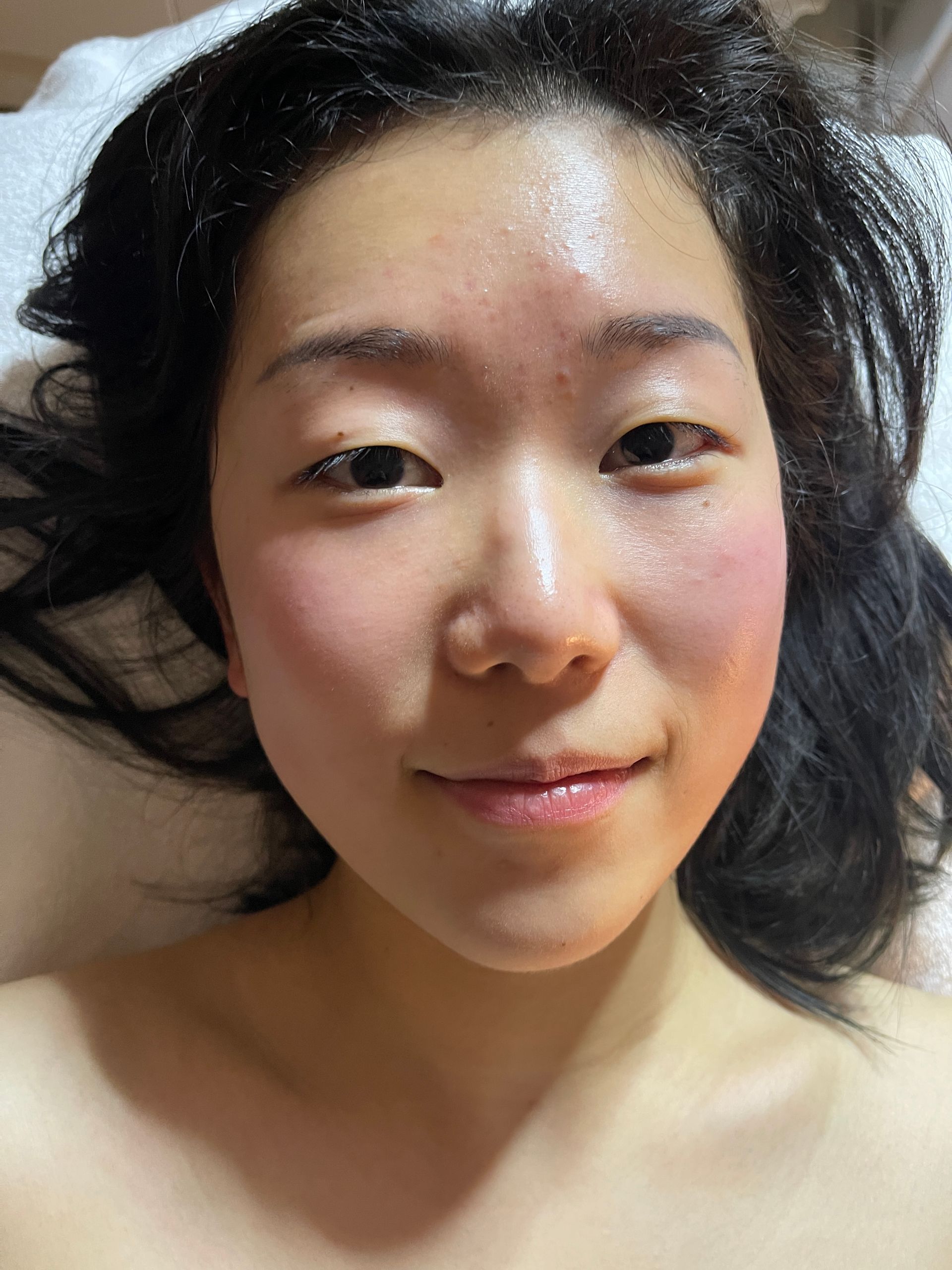 facial treatment