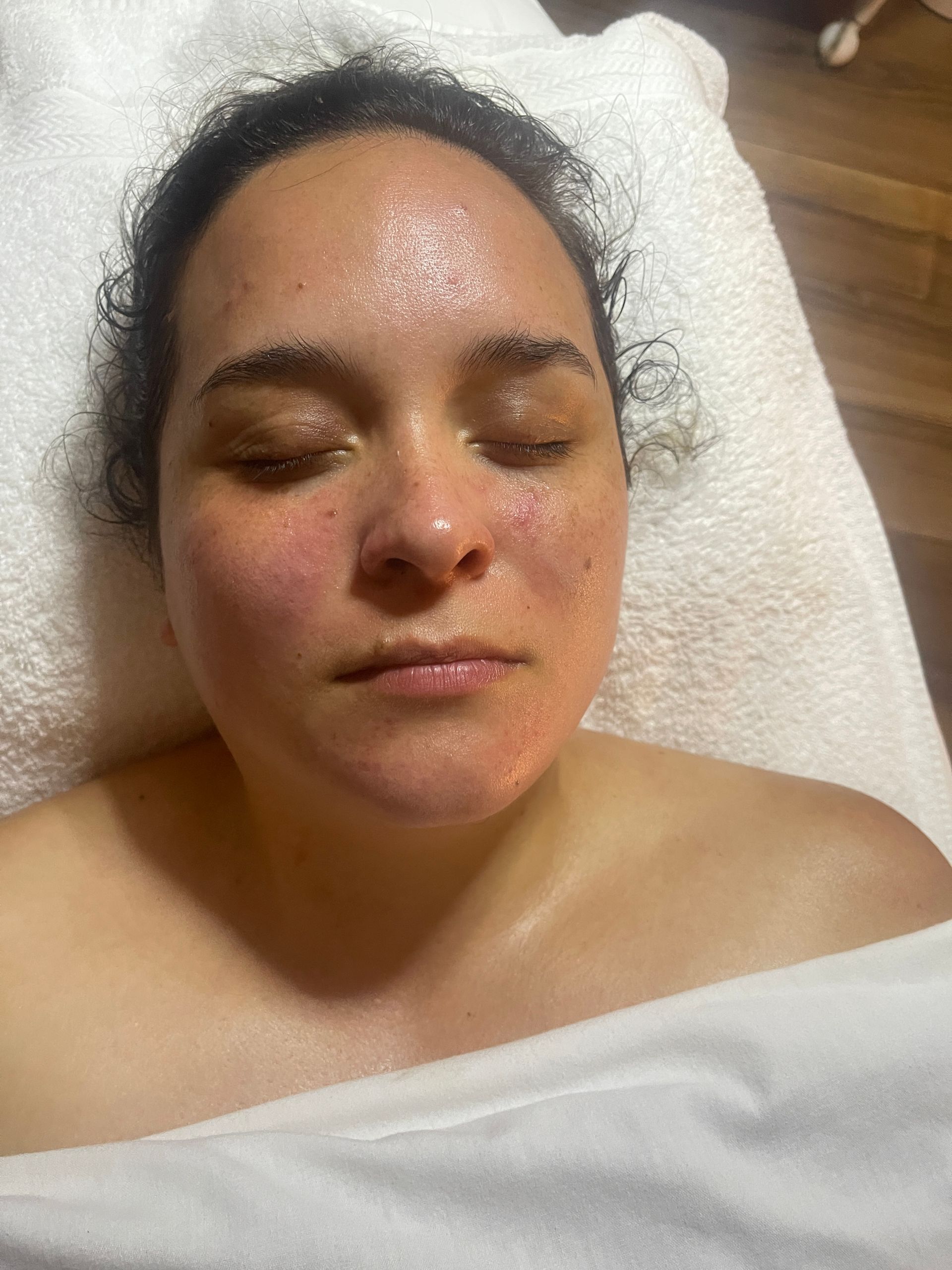 facial treatment