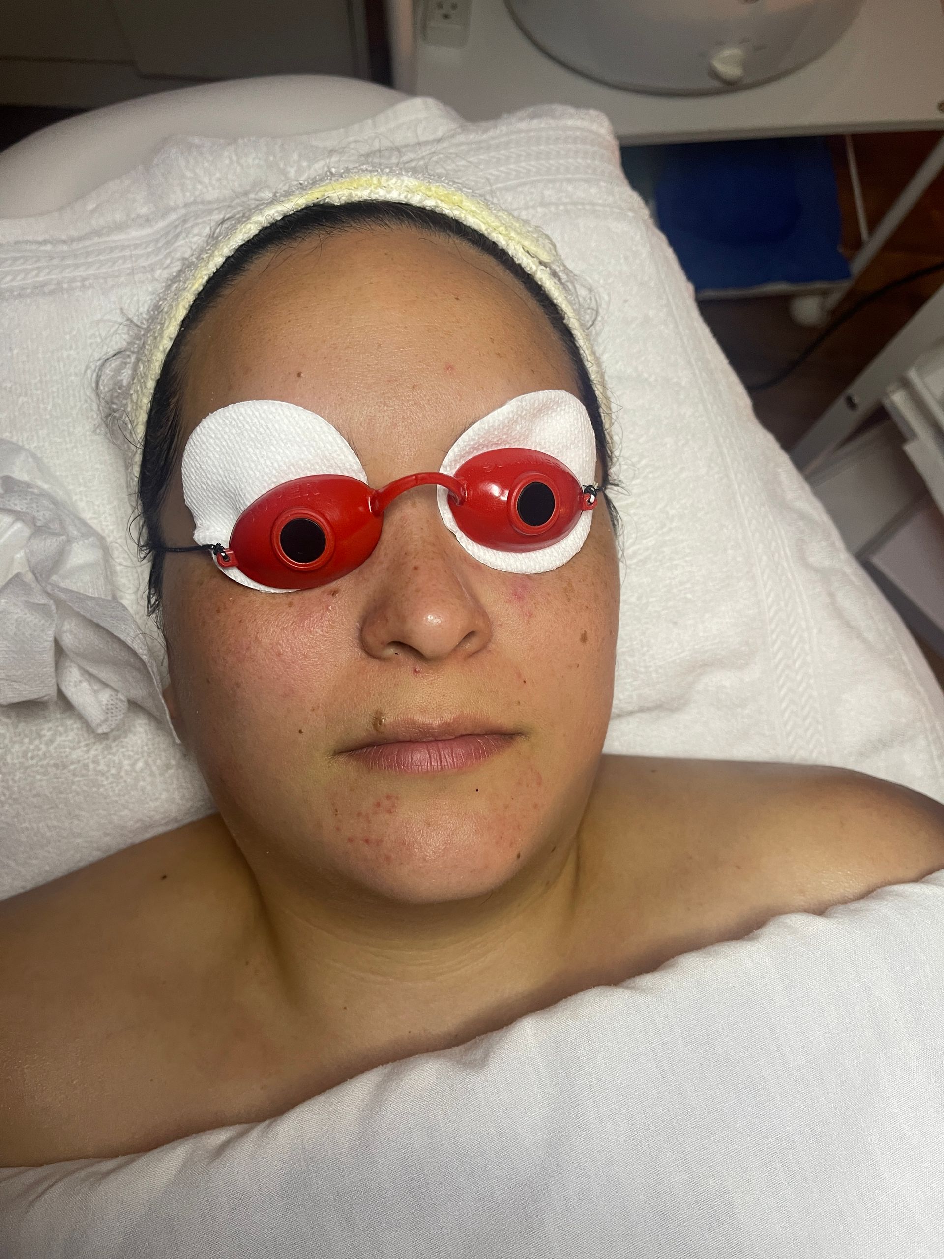 facial treatment