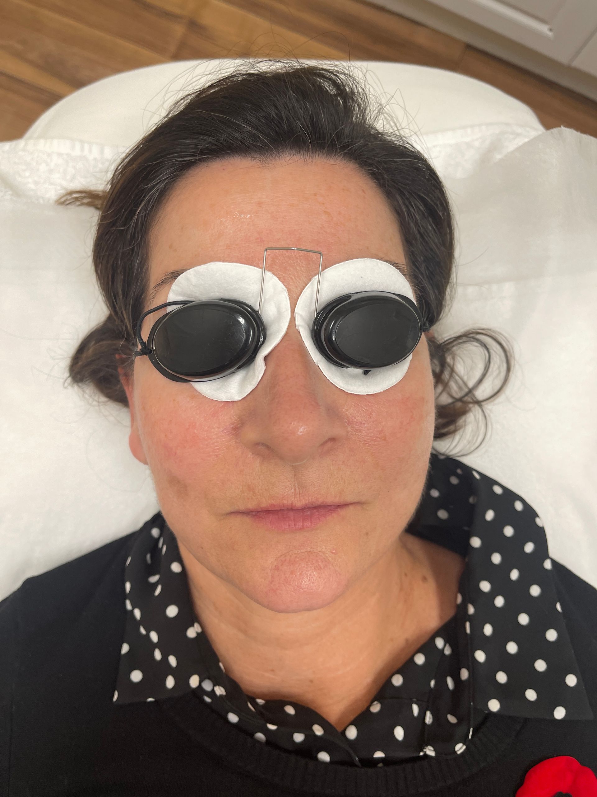 facial treatment
