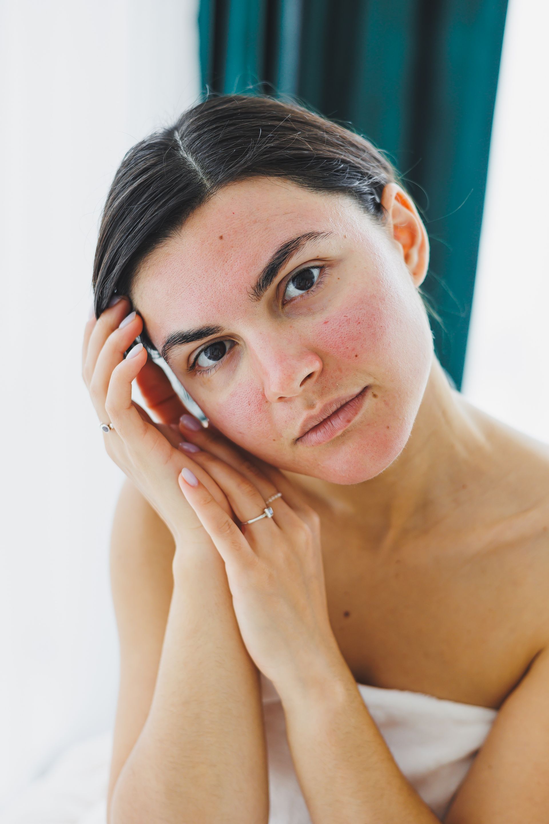 A woman with red spots on her face is sitting in front of a mirror.