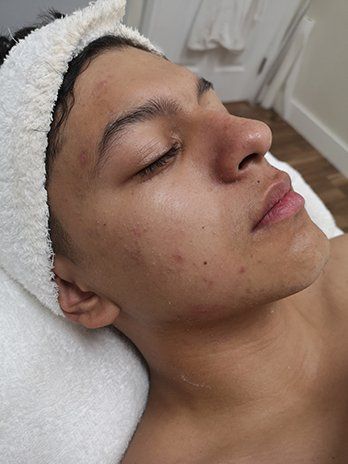 A young man is laying on a bed with a towel around his head.