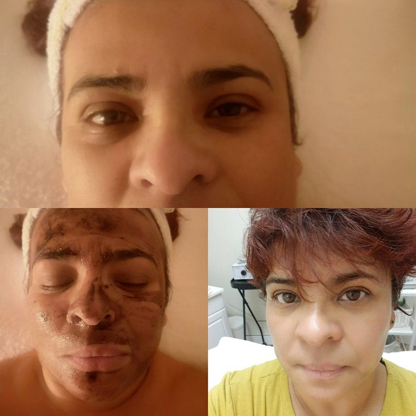 A woman 's face is shown before and after a facial treatment