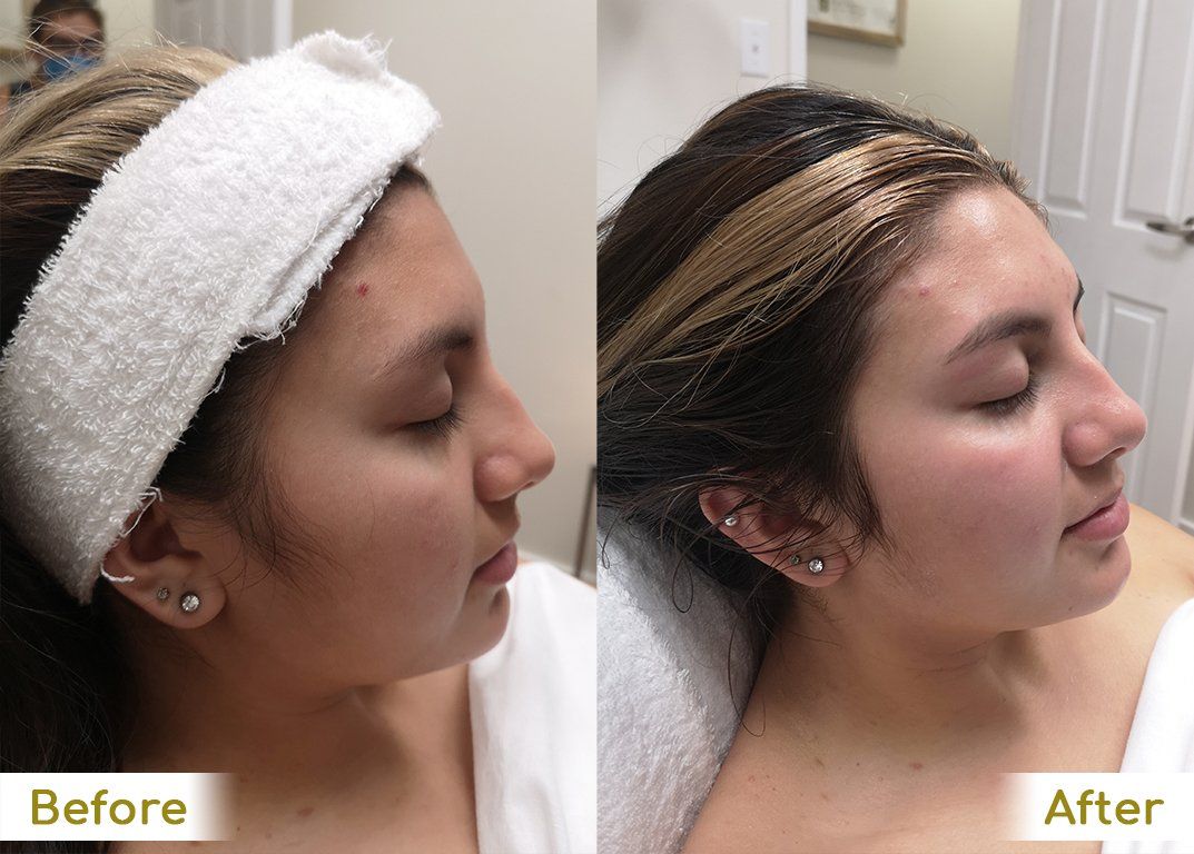 A before and after photo of a woman with a headband on her head.
