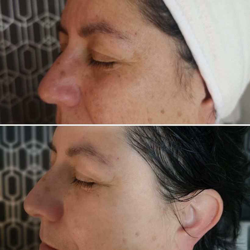 A before and after photo of a woman 's face