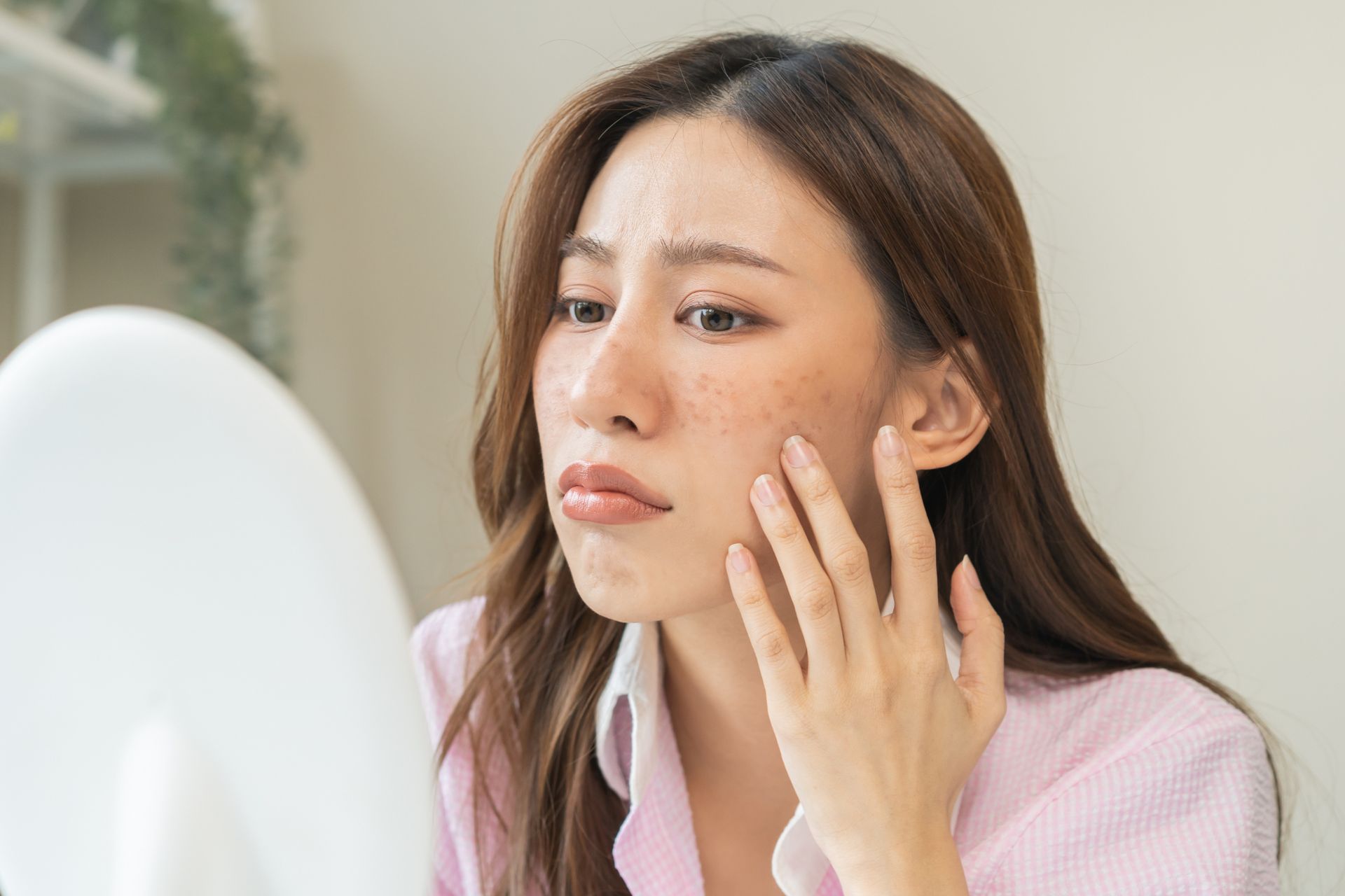 upset woman looking in mirror at hyperpigmentation spots on cheeks