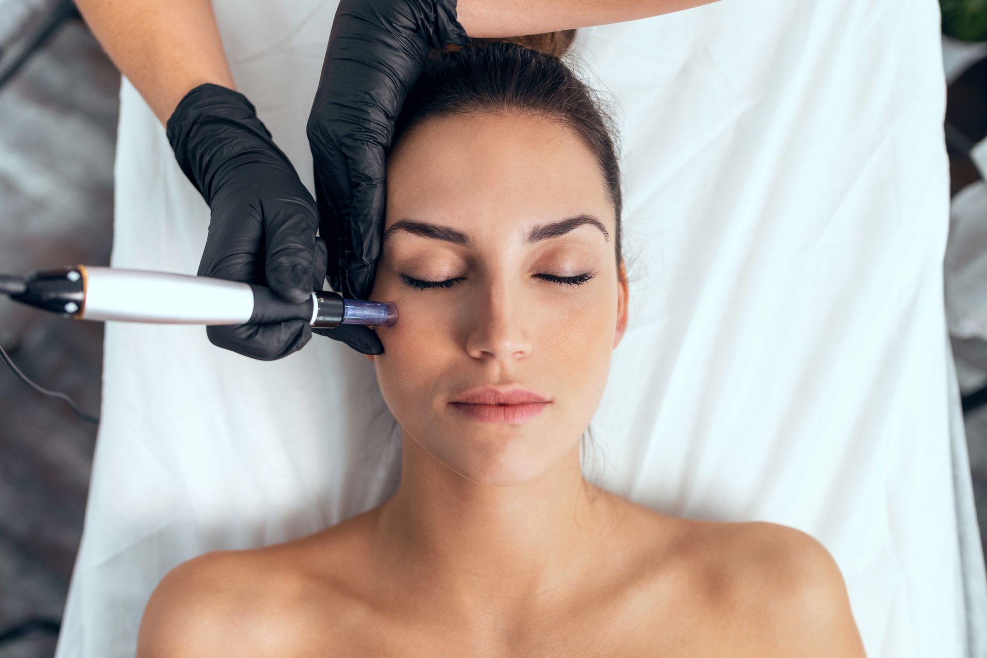 closeup of female patient receiving microneedling facial