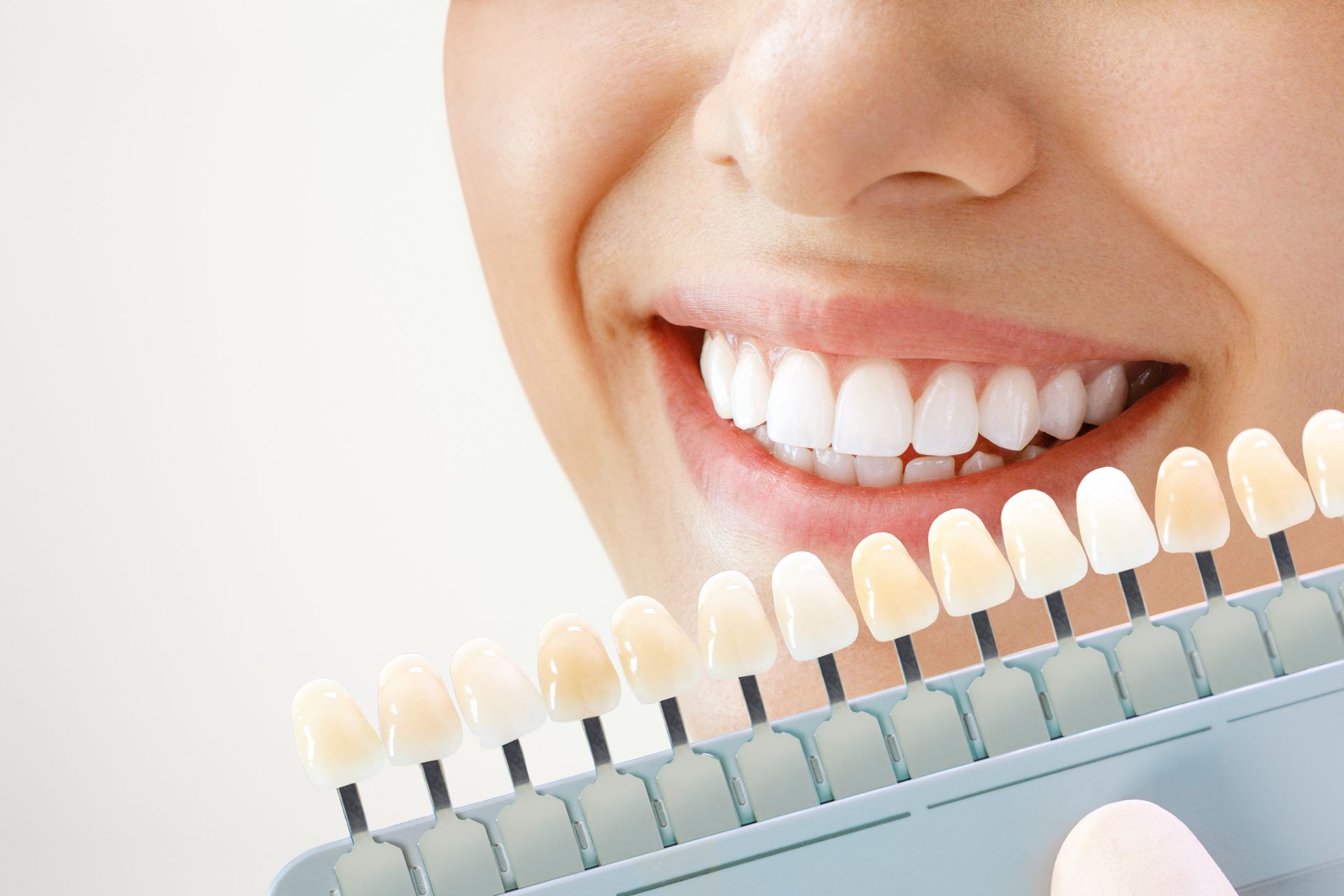Smiling mouth with white teeth beside a dental shade guide