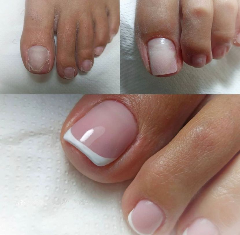 piedi